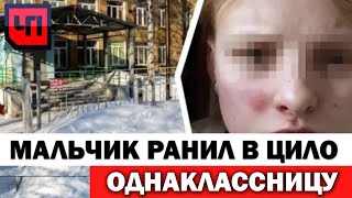 Пуля отрикошетила в лицо. Последние новости