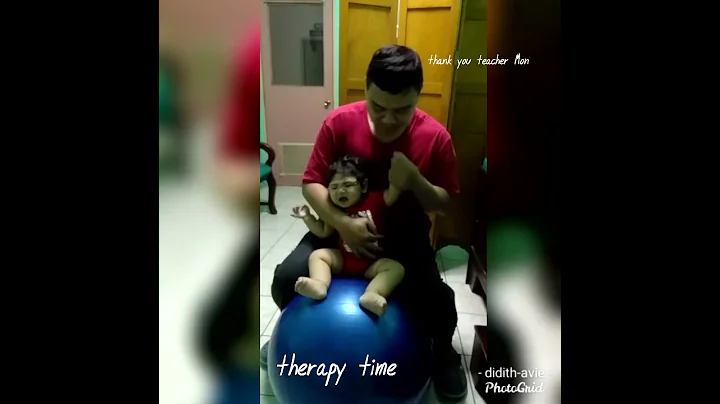 Physical therapy session for head control global development delayed microcephaly generalized epilep