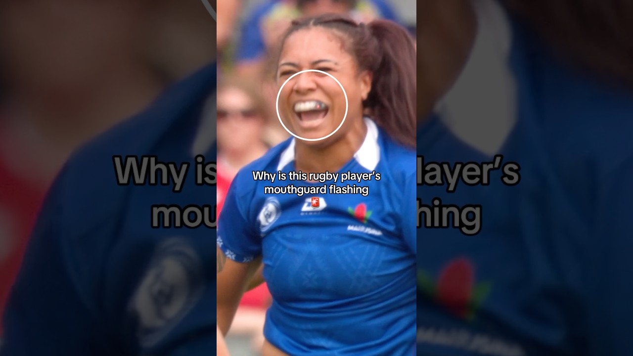 Using technology to protect Rugby players 🏉 