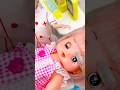 Satisfying With Unboxing Doll First Aid Kit Toys, ASMR Video #shorts