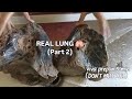 Lung Gross Anatomy on Real Specimen- PART 1 🫁 | Viva Questions | MBBS | NEETPG Prep @glowwithpriyya