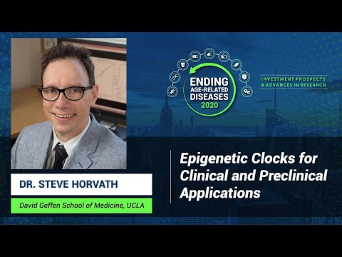 Steve Horvath |