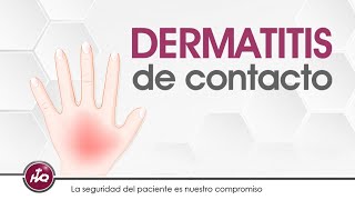 Dermatitis De Contacto Causas Sntomas Y Consejos