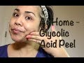 At Home - How To Glycolic Acid Peel