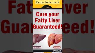 Fatty liver cure shorts fattyliver fattylivertreatment fattyliverdisease liverhealth lifestyle