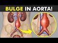 Aortic Aneurysm Explained: Symptoms, Causes, and Treatments