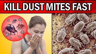 How to Get Rid of Dust Mites in Your House, Bed & Carpet Naturally by Natural Health Remedies 2,249 views 1 month ago 8 minutes, 2 seconds