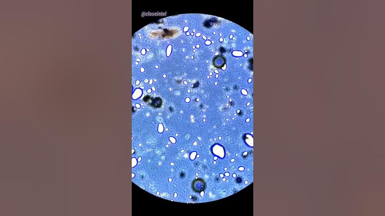 Probiotic capsules under microscope do dry probiotics work youtube
