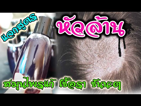 แจกสูตร!!!ยาสระผมสมุนไพร หยุดล้าน แก้ชันนะตุ เชื้อราบนหนังศีรษะ แบบง่ายๆๆ (ได้ผล 100%)l Easy home