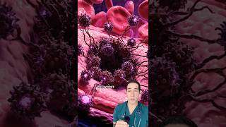 Download Lagu You won’t believe what they found in his lung! MP3