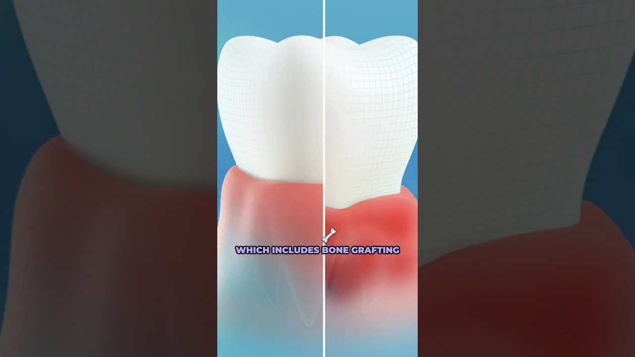 Zeeba Advanced Dental Education Presents The Implant Mentorship