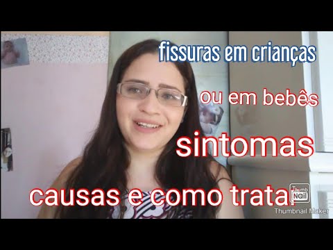 Vídeo: Como Tratar Fissuras Em Uma Criança