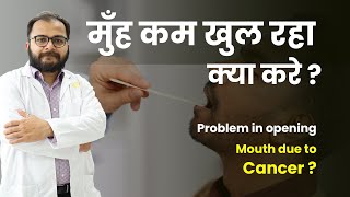 मुँह कम खुल रहा है क्या करे  Problem in opening mouth due to Cancer  Dr. Siddharth Nagshet