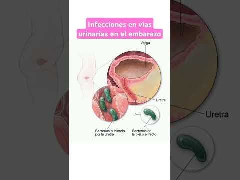 INFECCIONES URINARIAS EN