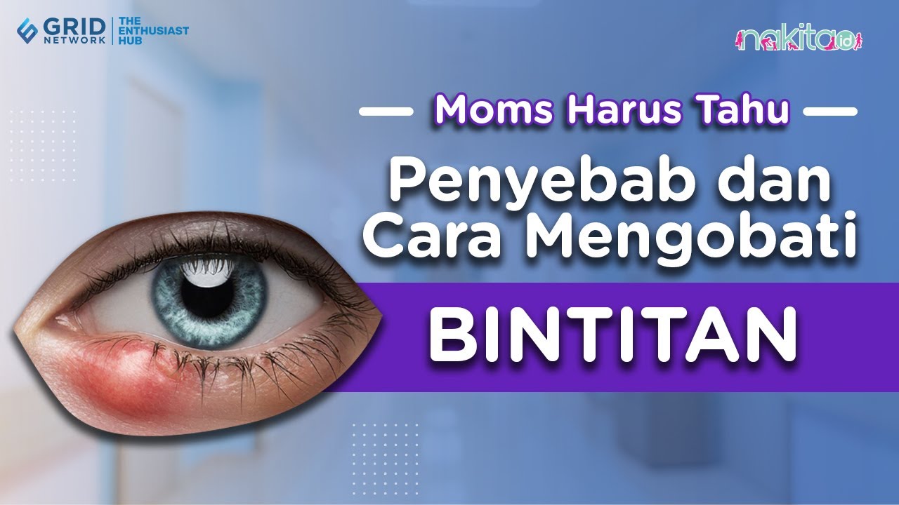 Penyebab dan Cara Mengobati Bintitan, Solusi Terbaik untuk Mengatasinya