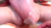 ベビーフット 足の裏の皮を剥いてみた 見るasmr 脱皮 足パック Exfoliation It Feels Good Movie Youtube