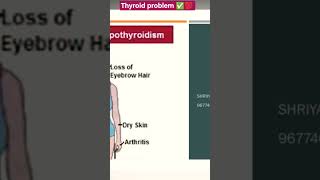 Thyroid problem ✅💯 #shorts #viral #trending #health #thyroidproblems #healthcare #naturopathy #tamil