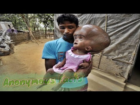 ადამიანთა შოკისმომგვრელი მუტაციები