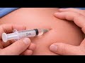Gluteal IM Injection Made Easy | Safe Step-by-Step Guide for Beginners"