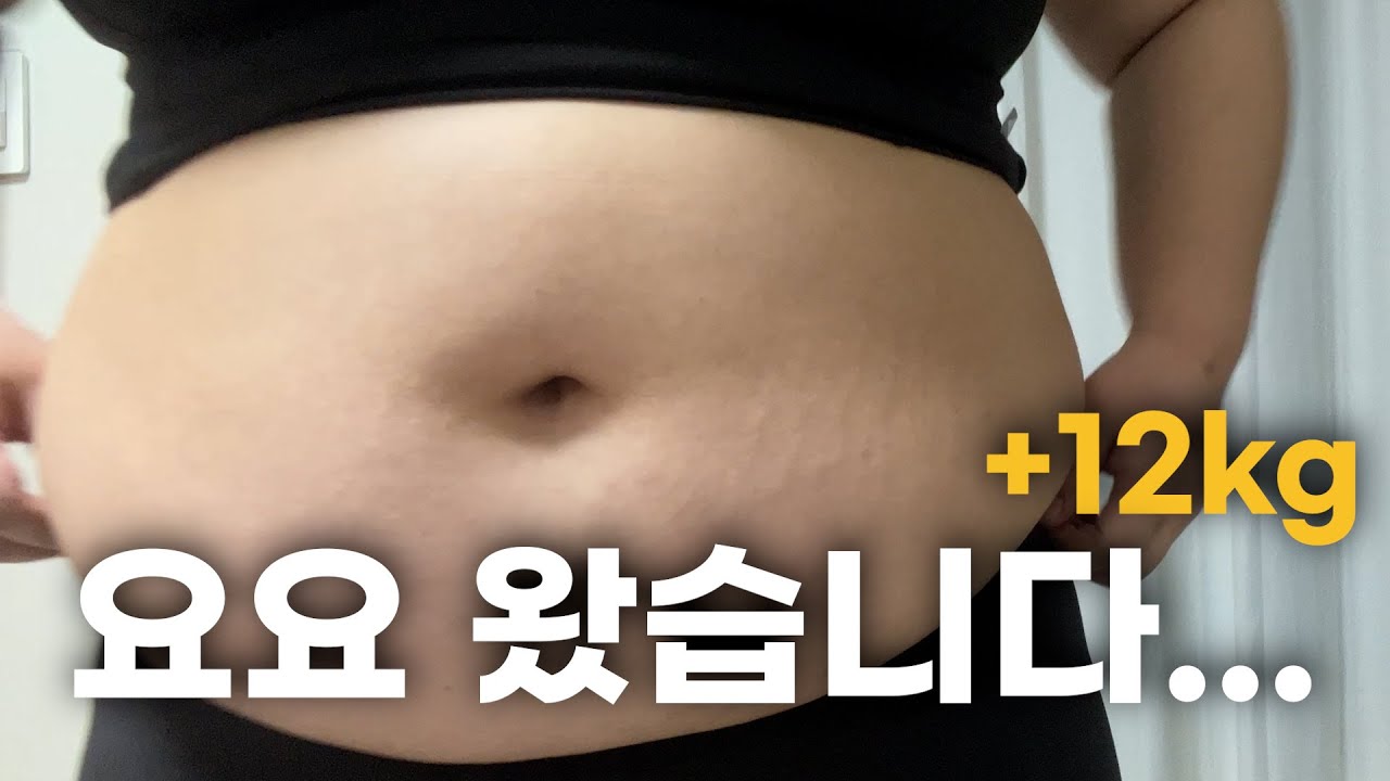 초고도비만이 입 터지면 생기는 일