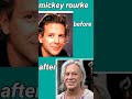 10 celebrity ,plastic surgery disastered