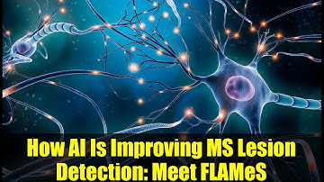 How AI Is Improving MS Lesion Detection: Meet FLAMeS