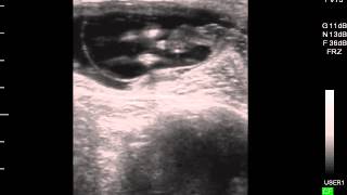Bovine Ultrasound Fetal Sexing - ultrasound