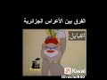 اضحك من قلب مع اعراس جزائرية توم وجيري 