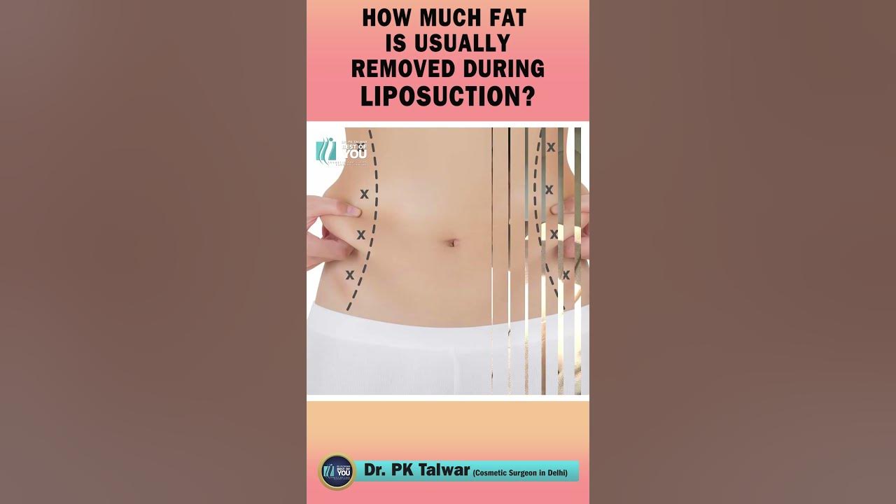 how-much-fat-can-be-removed-during-liposuction-liposuction-surgery-in