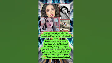 جيمري بايسال تكشف تفاصيل مرضها الذي عانت منه لمدة سنة كاملة 