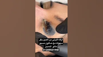 ازاله وشم العين مع صالون مسيو مانو للحجز 01205521948 