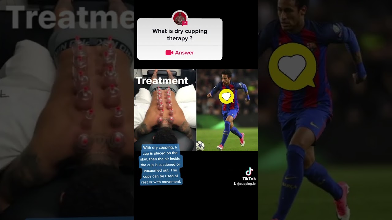 What is dry cupping therapy.