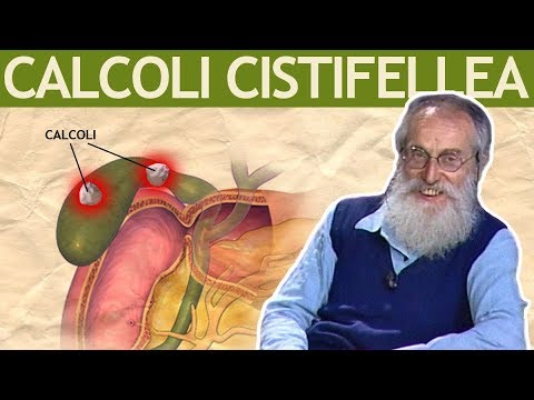 Dott. Mozzi: Calcoli alla cistifellea, biliari, colecisti