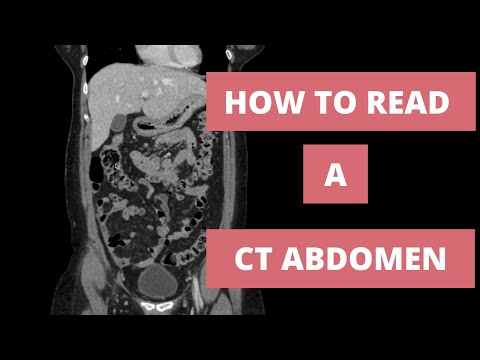 How to read a CT Abdomen for Med students and Residents - Part 1