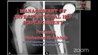 Management Of Infected Total Hip Replacement Prof Mohamed El-Ashhab