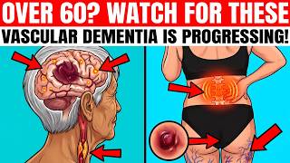 OVER 60 7 Signs Vascular Dementia Is Progressing