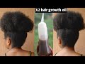 Use This Amla oil Twice a Week And Your Hair will Gow like Crazy/grow massive thick and longer hair