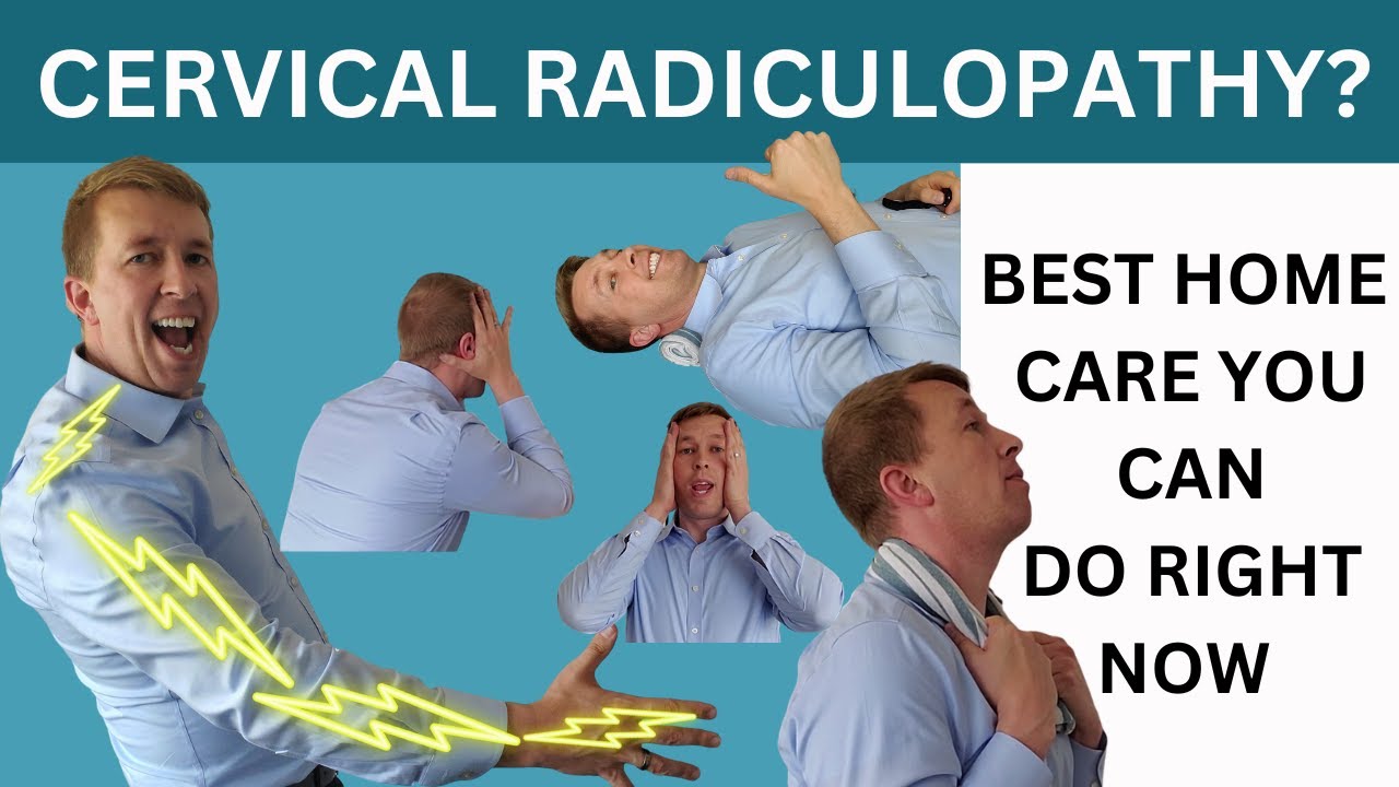 4 лучших упражнения для облегчения шейной радикулопат...