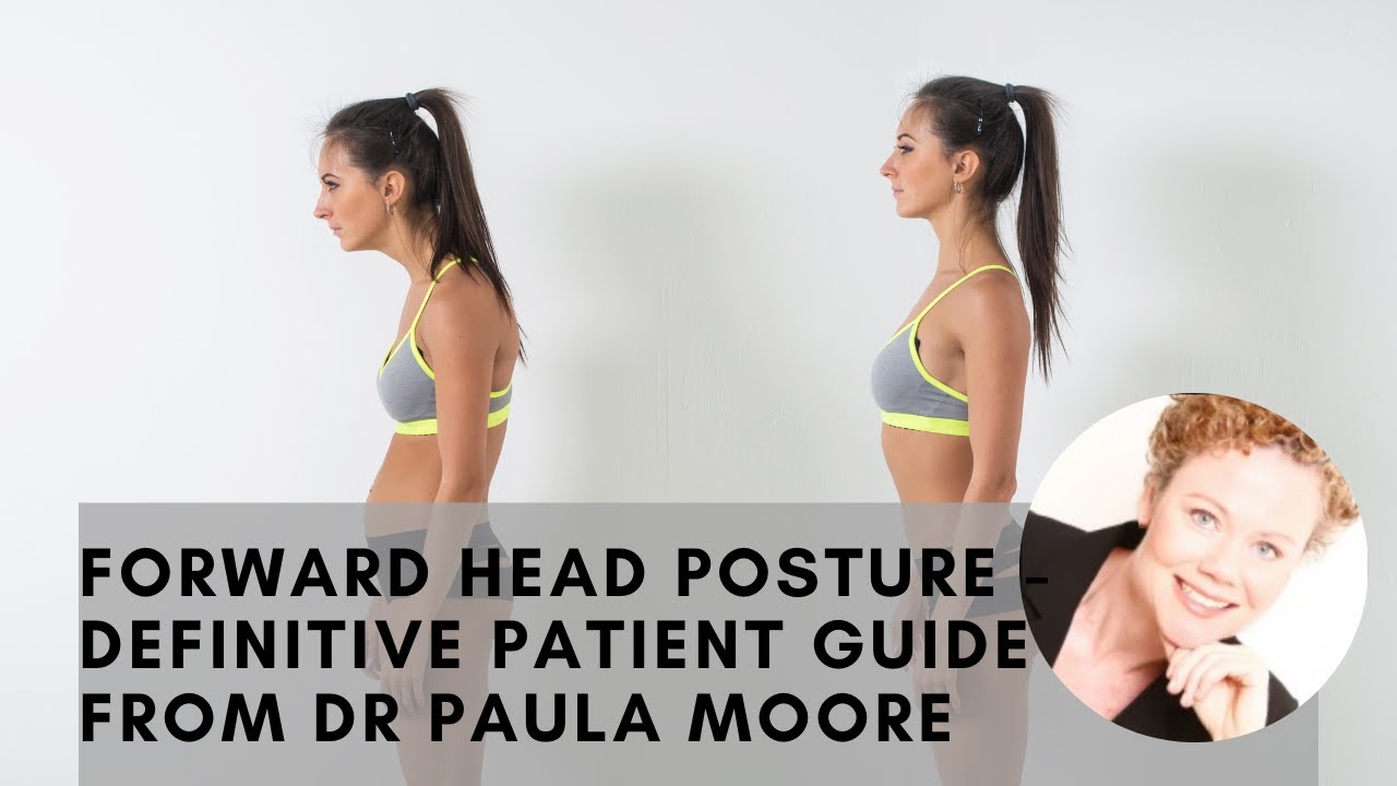 Forward Head Posture - Complete Patient Guide From Dr Paula Moore