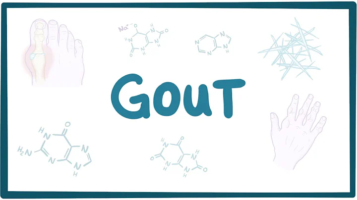 Gout - causes, symptoms, diagnosis, treatment, pathology - DayDayNews