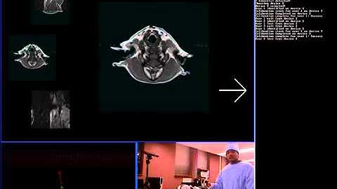 Surgeons Use Hand Gestures to Control MRI Images in OR