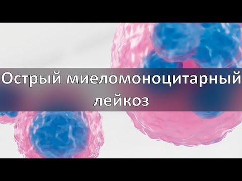 Острый миеломоноцитарный лейкоз