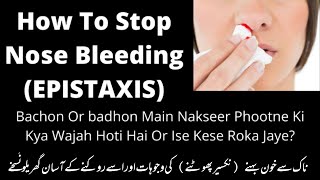 How To Stop a Nosebleed In Child And Adult | Causes And Prevention Tips For Epistaxis /Nosebleed