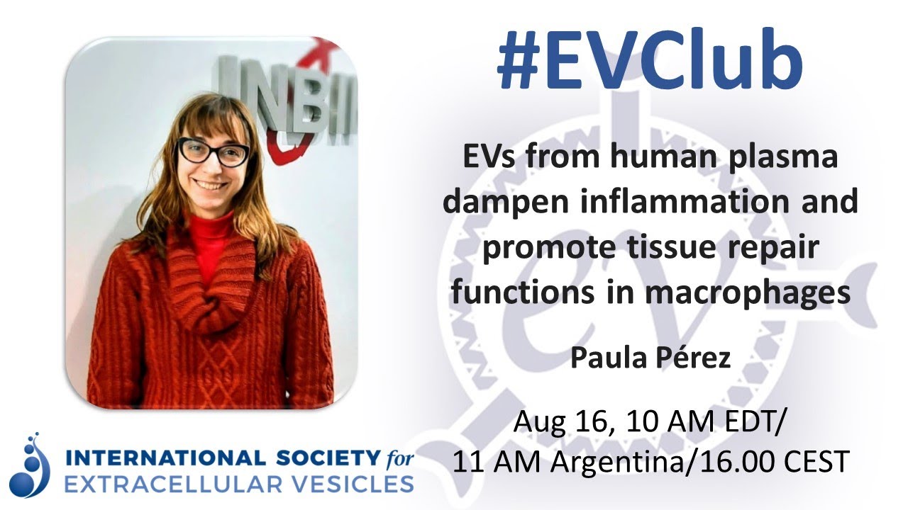 Solesmad Rip Paula Soledad Pérez: EVs, inflammation, and macrophage tissue repair ...