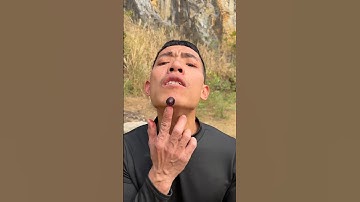 How I Cured a Bug Bite with Yogurt in theWild | Survival Hacks#asmr#comedy