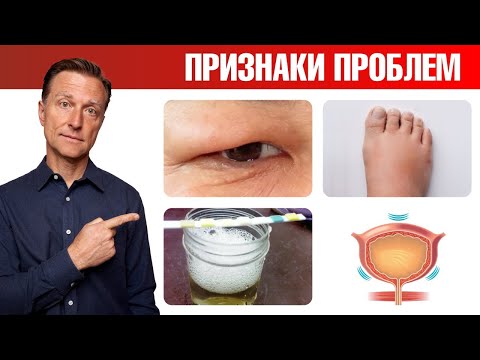 Заболевания почек: 10 признаков, что с почками беда😲