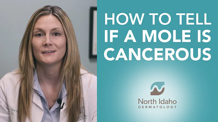 How to Tell if Your Mole is Cancerous - North Idaho Dermatology - DayDayNews