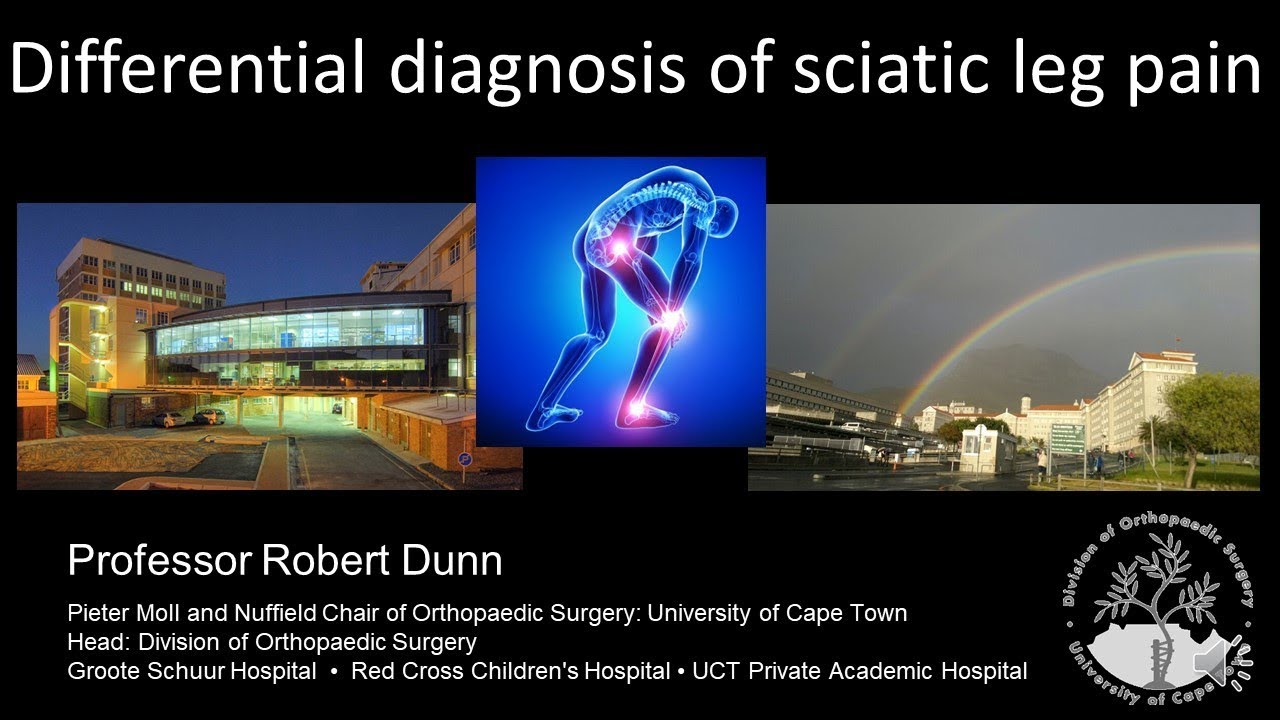 Differential diagnosis of sciatic leg pain with audio 2019 YouTube