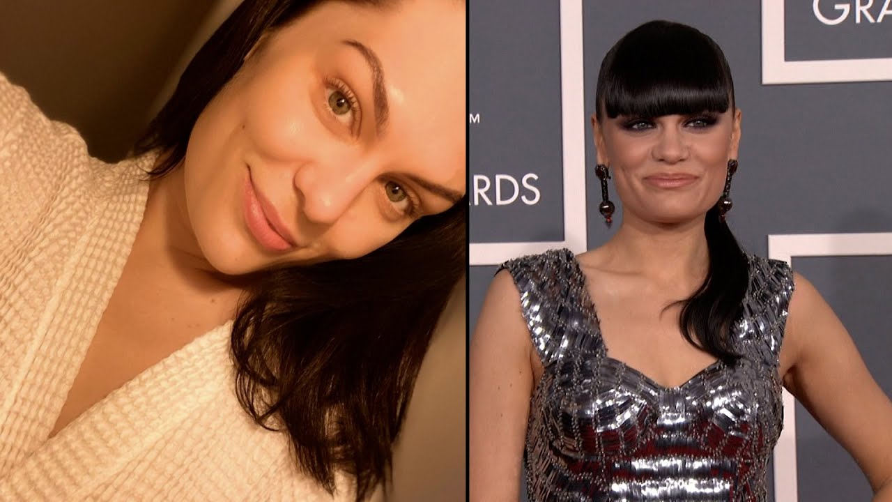 Jessie J diagnosed with Meniere's Disease after waking up ...