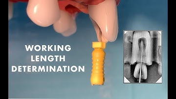 Preclinical laboratory demonstration - working length determination